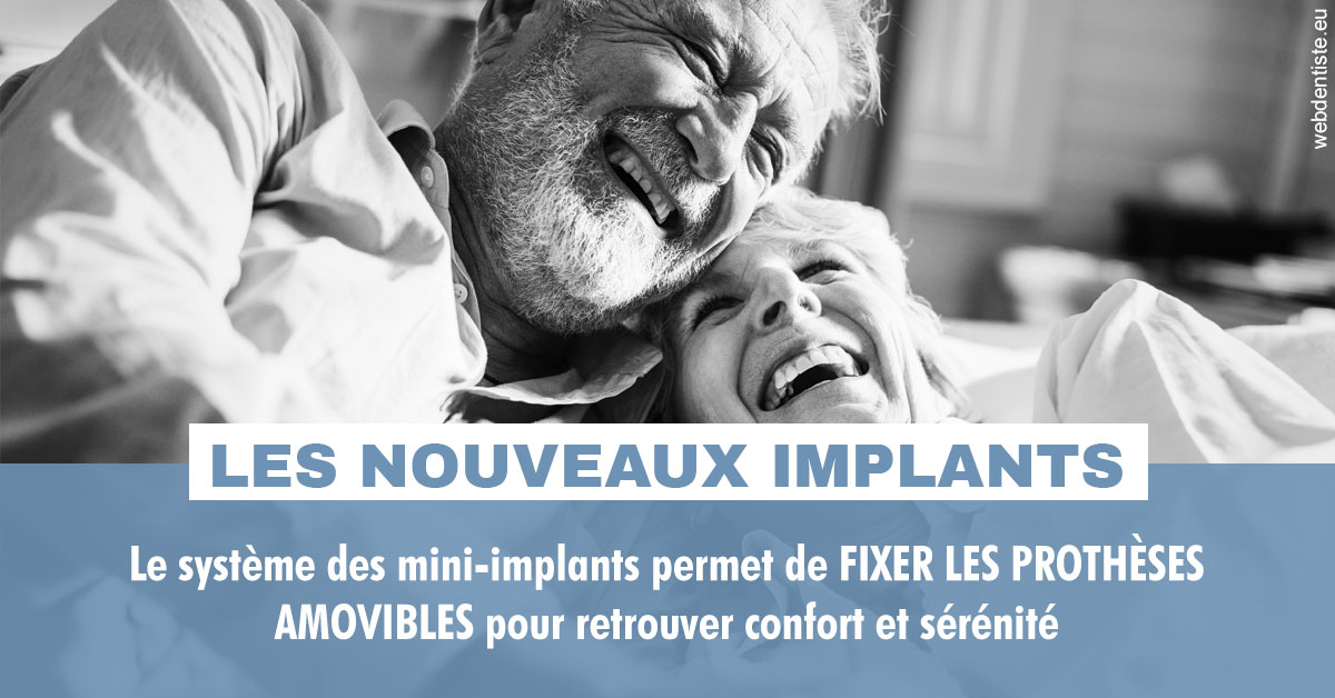 https://dr-vidal-alain.chirurgiens-dentistes.fr/Les nouveaux implants 2