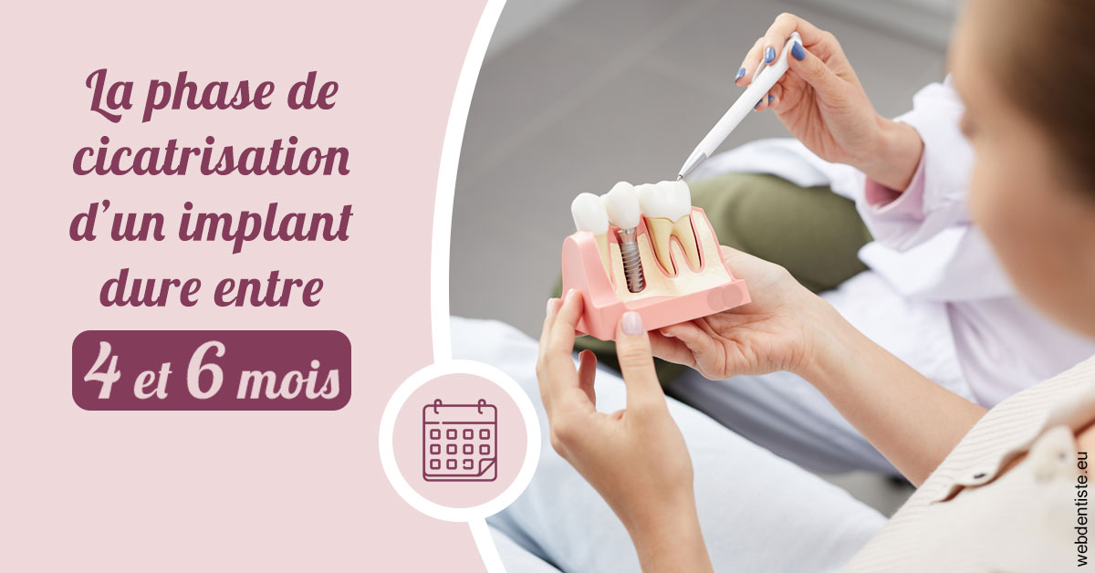 https://dr-vidal-alain.chirurgiens-dentistes.fr/Cicatrisation implant 2