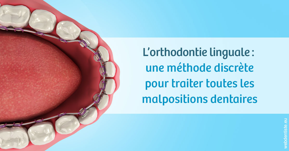 https://dr-vidal-alain.chirurgiens-dentistes.fr/L'orthodontie linguale 1