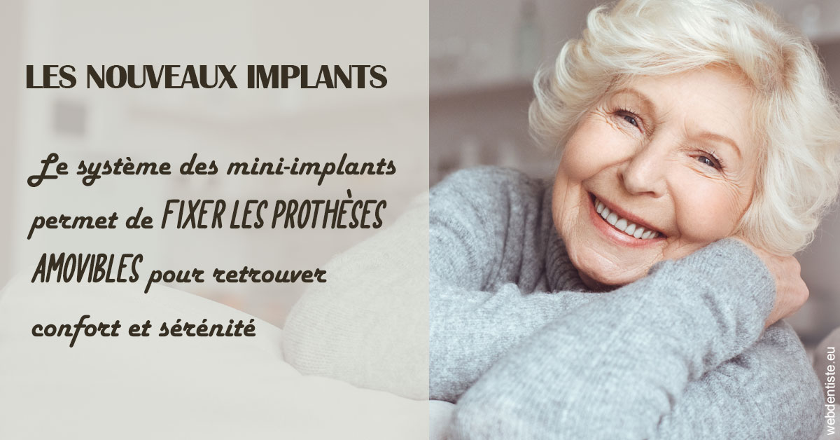https://dr-vidal-alain.chirurgiens-dentistes.fr/Les nouveaux implants 1