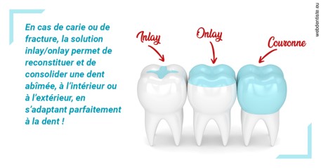 https://dr-vidal-alain.chirurgiens-dentistes.fr/L'INLAY ou l'ONLAY