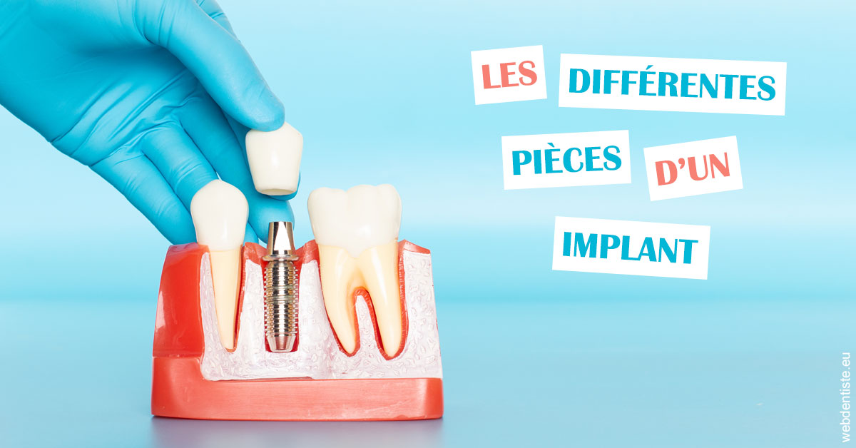 https://dr-vidal-alain.chirurgiens-dentistes.fr/Les différentes pièces d’un implant 2