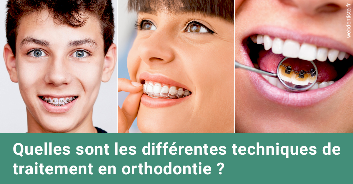 https://dr-vidal-alain.chirurgiens-dentistes.fr/Les différentes techniques de traitement 2