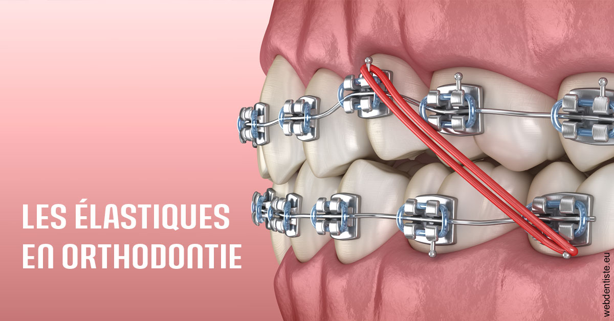 https://dr-vidal-alain.chirurgiens-dentistes.fr/Elastiques orthodontie 2