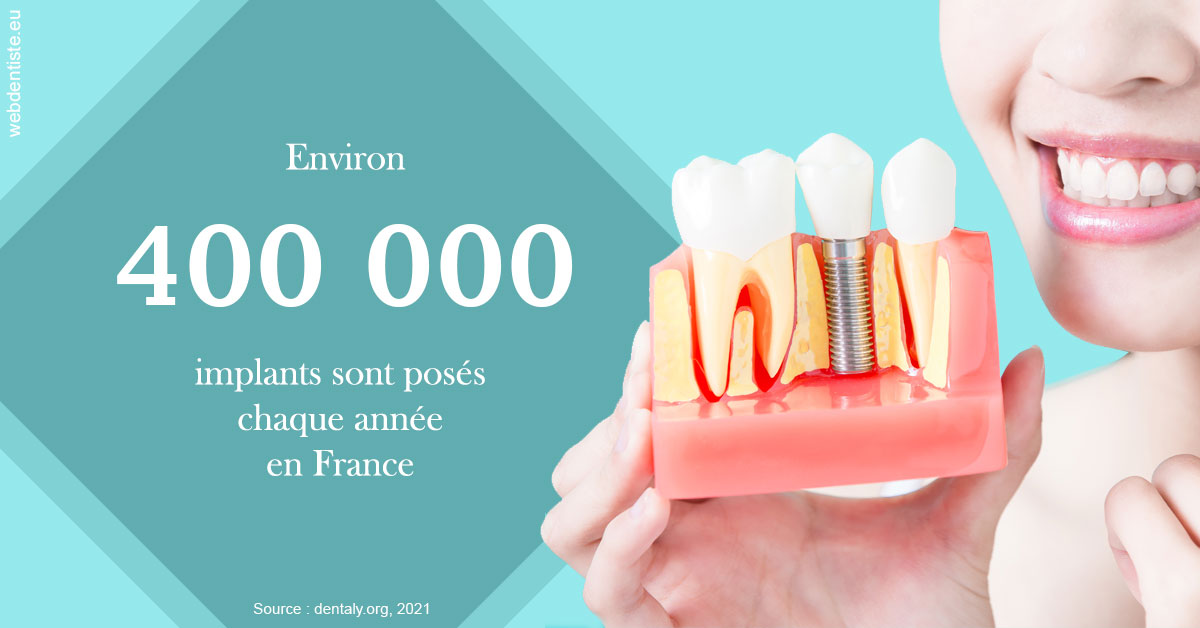 https://dr-vidal-alain.chirurgiens-dentistes.fr/Pose d'implants en France 2