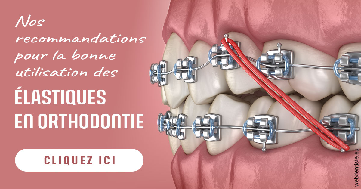 https://dr-vidal-alain.chirurgiens-dentistes.fr/Elastiques orthodontie 2